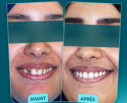 Advanced Restorations Mastery