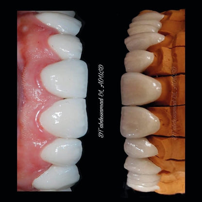 Advanced Restorations Mastery