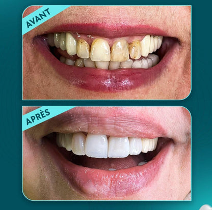 Advanced Restorations Mastery