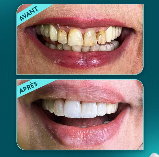 Advanced Restorations Mastery