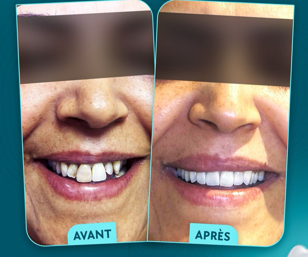 Advanced Restorations Mastery