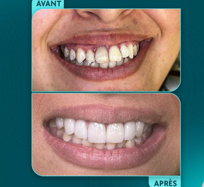 Advanced Restorations Mastery